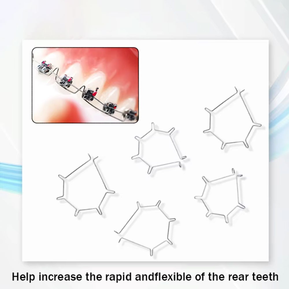 Dental Orthodontic Anterior Root Torquing Auxiliary Arch 5Pcs/Pack All Size