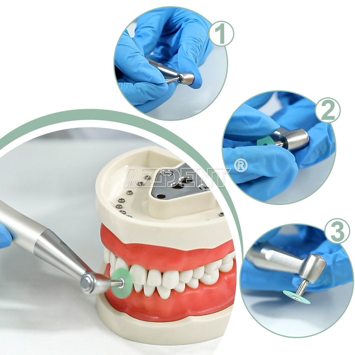 5 Kit de Discos de Pulido para Composite Dental 12mm +14 mm 80pcs + Mandril