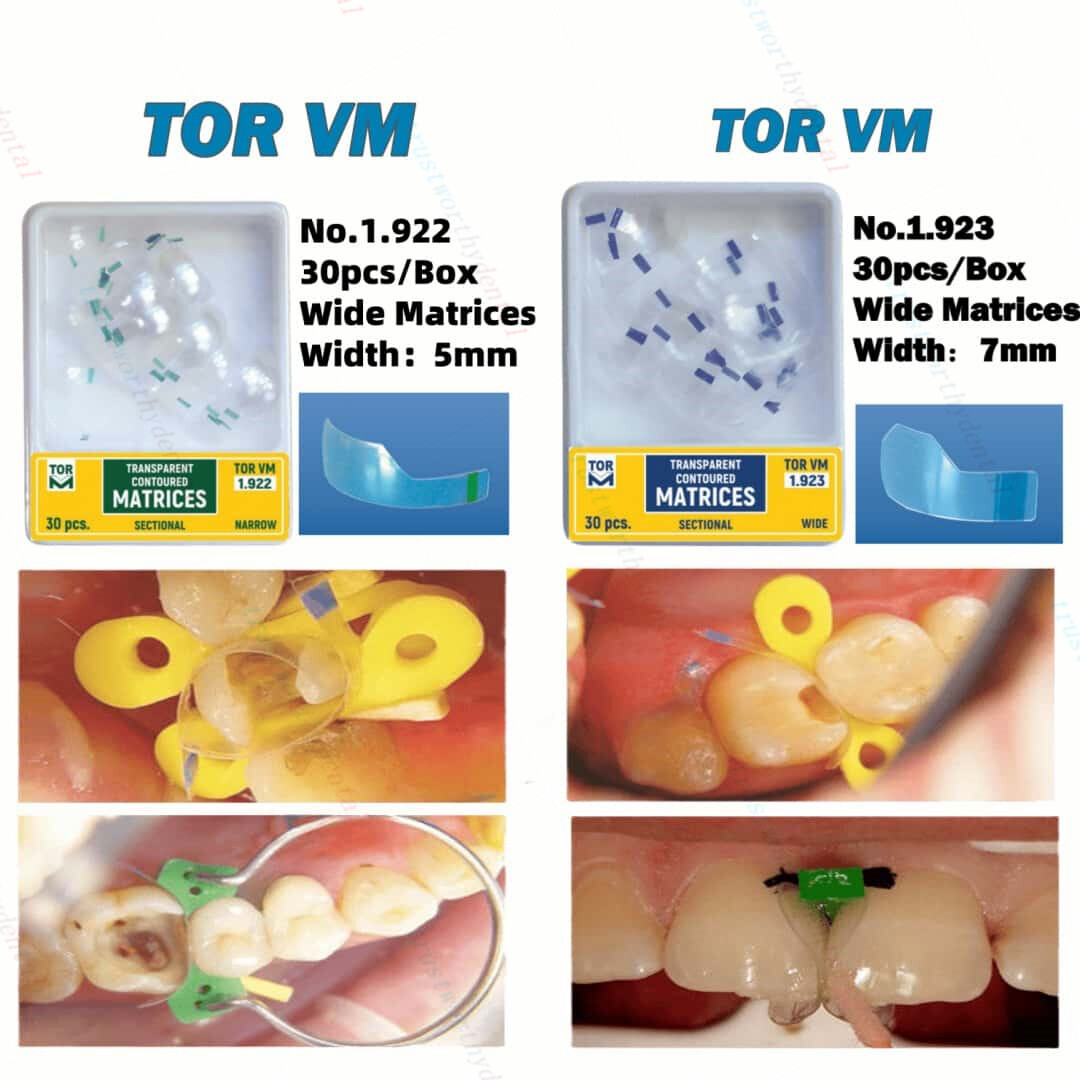 60pc Dental Clear Matrix Transparent Sectional TOR VM Matrices Polyester Matrice
