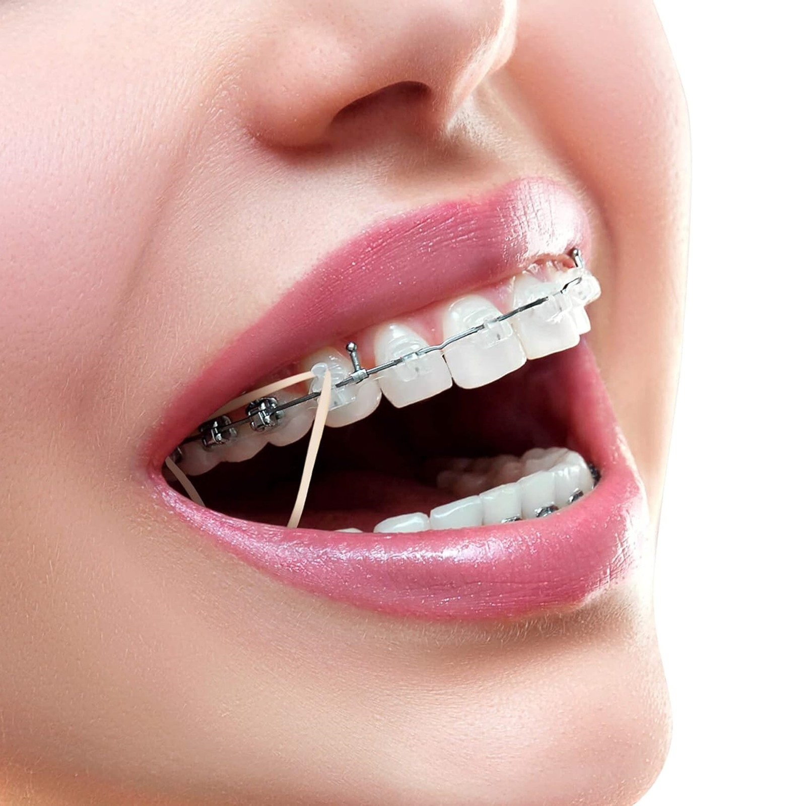 US Dental Orthodontic Elastics Rubber Bands Latex Braces 3.5OZ 5.0OZ 6.5OZ