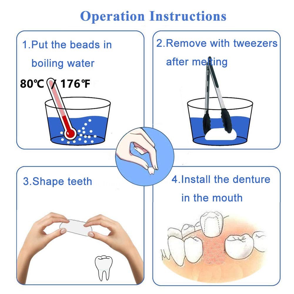 Brige Tooth Repair kit for Filling The Missing Broken 1 Count (Pack of 1)