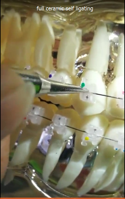 Dental Orthodontic Braces Self-Ligating Sapphire Ceramic Brackets Roth/MBT 022′