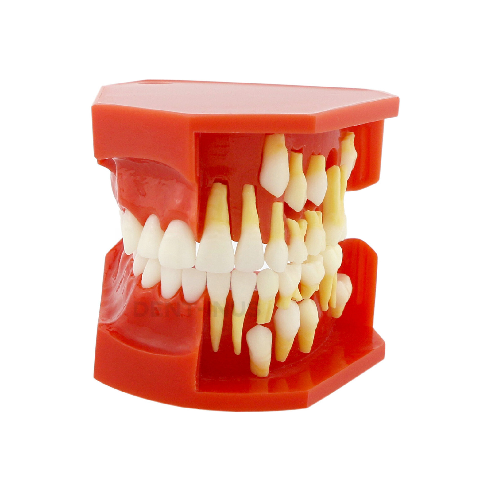 Multiple Types Dental Teeth Model Typodont Ortho Implant Practice Demo Teaching
