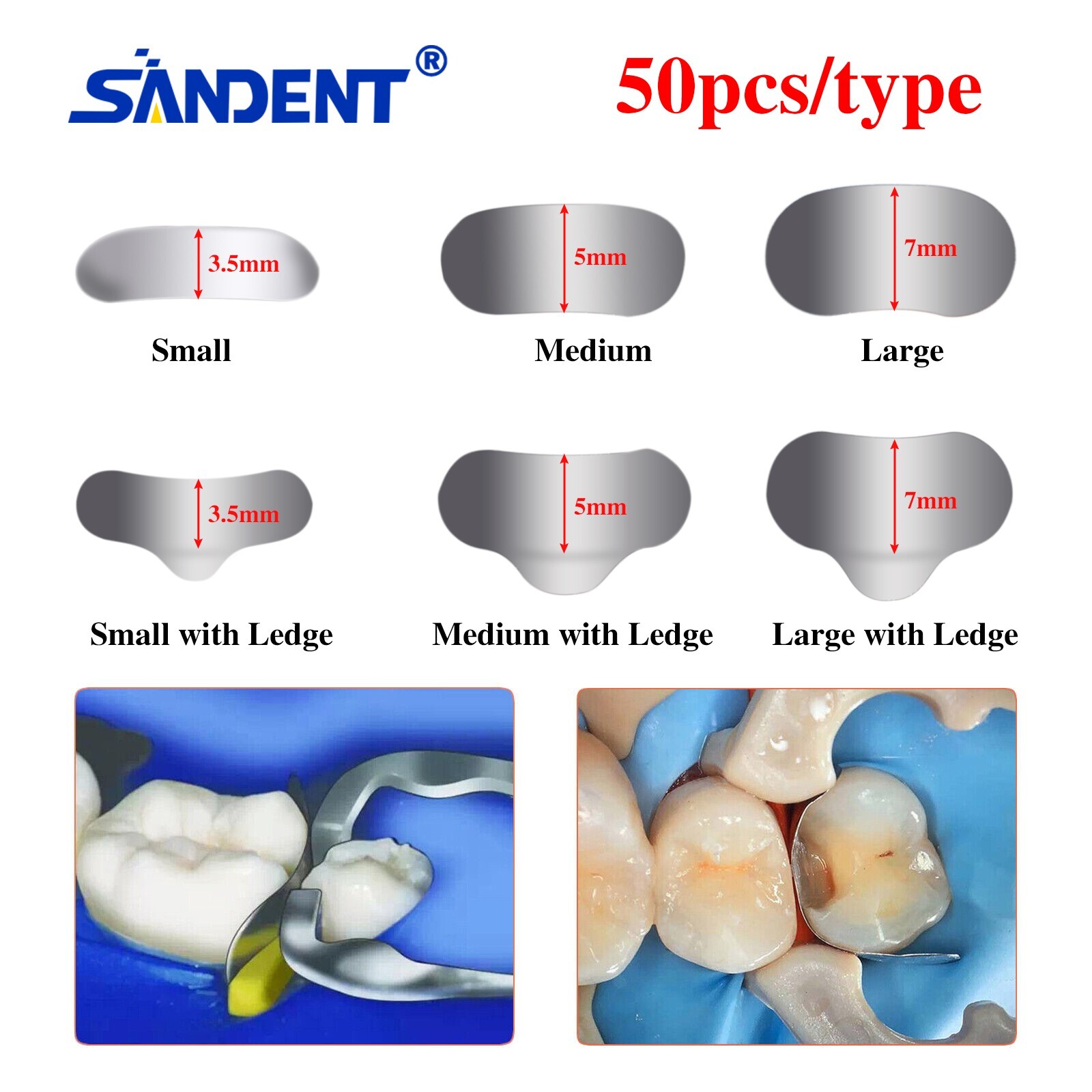 50Pcs/box Dental Sectional Contoured Matrices Matrix Bands Refill S/M/L