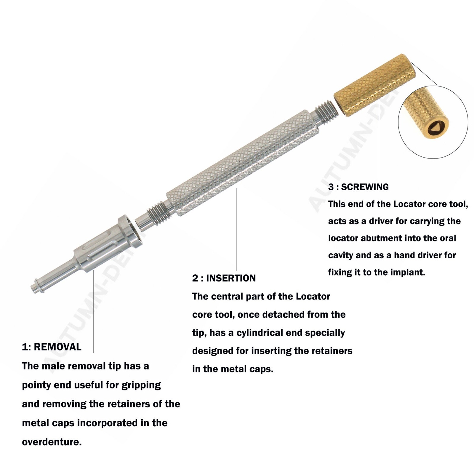 Dental Strong Retentive Caps Overdenture Metal Housing Attachments Abutments
