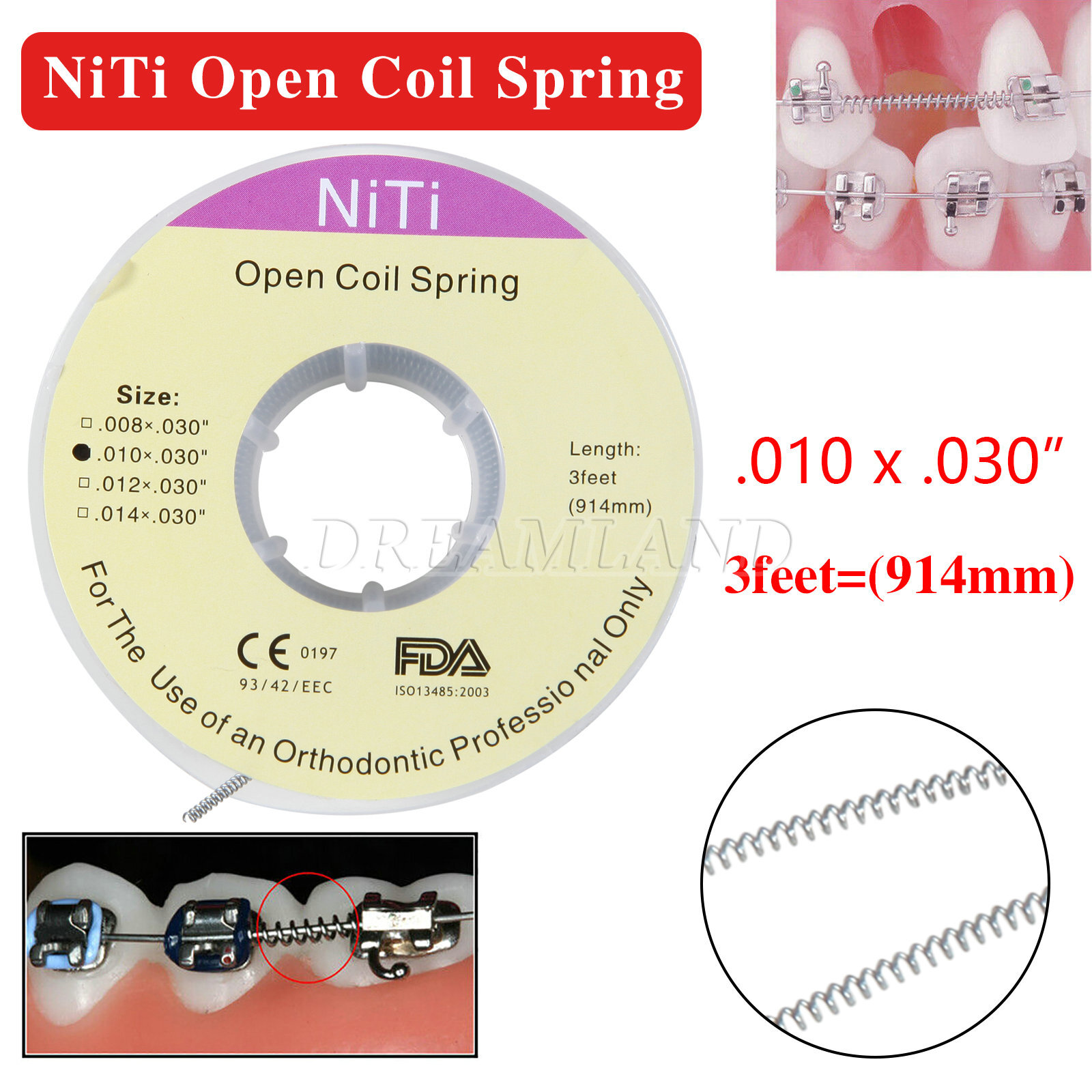 Dental Ortho Niti Open Coil Spring 010*030″ *914mm