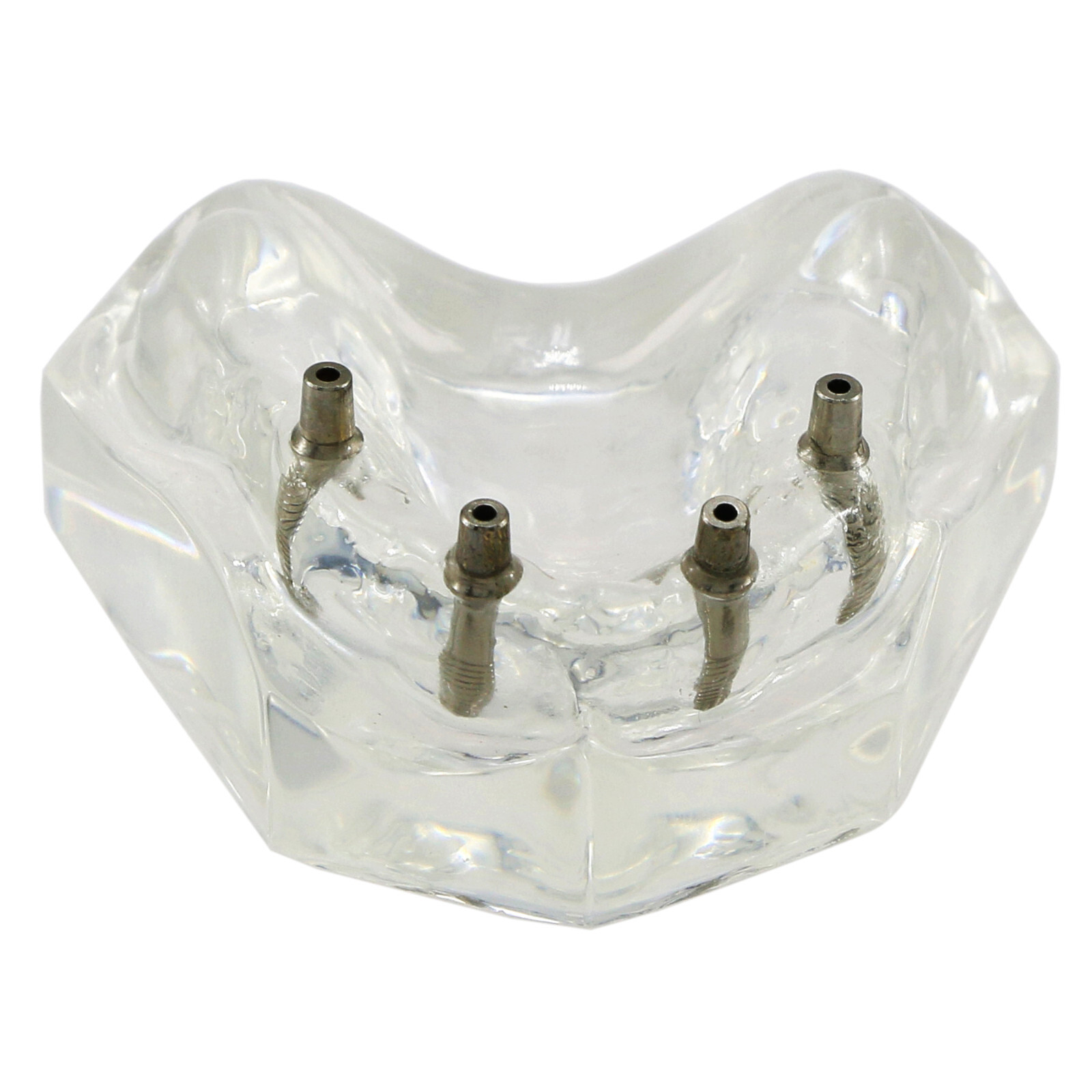 Implant Typodont Teeth Restoration Model Overdenture Practice Demo Series Dental
