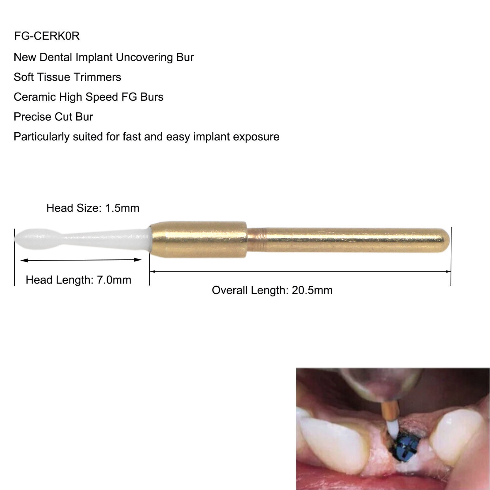 Dental Surgical Ceramic Soft Tissue Trimmer Bur for Gingivectomy