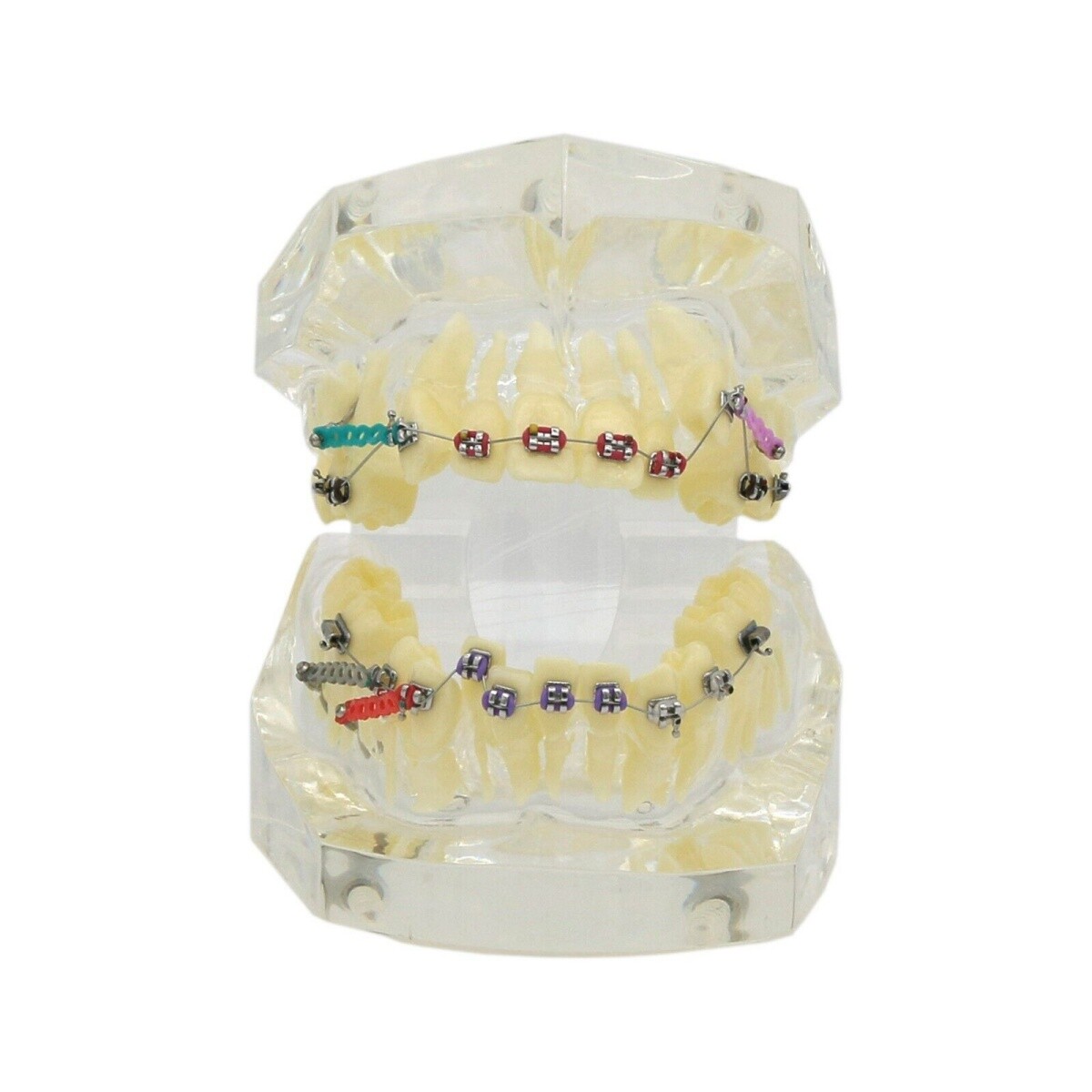Dental Typodont Teeth Model Orthodontic Treatment Metal Ceramic BracketsRetainer