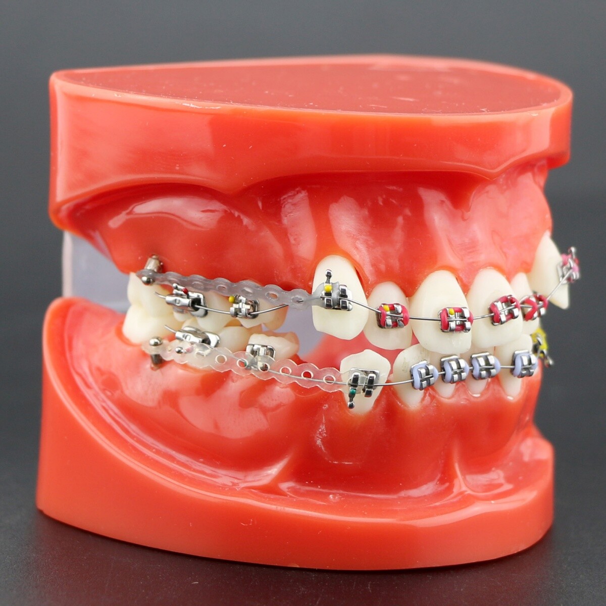 Dental Typodont Teeth Model Orthodontic Treatment Metal Ceramic BracketsRetainer
