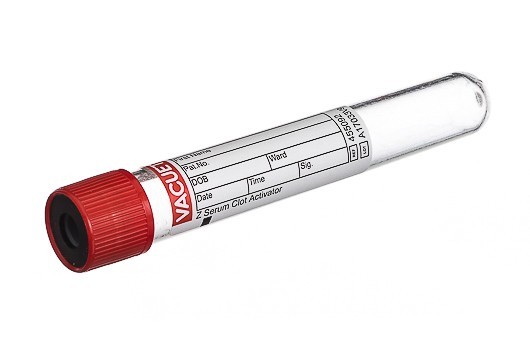 100x Greiner Bio-One (GBO) 9mL Red Top Serum Tubes