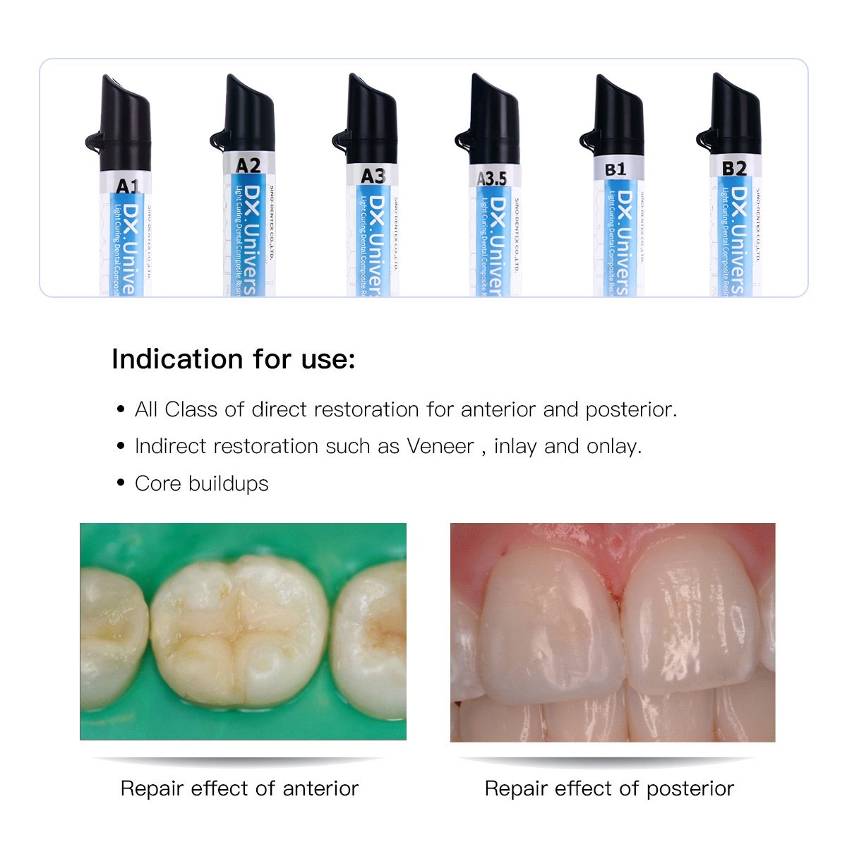 Dental Universal Light Cure Composite Resin/Etching Gel/Bonding Adhesive Kit