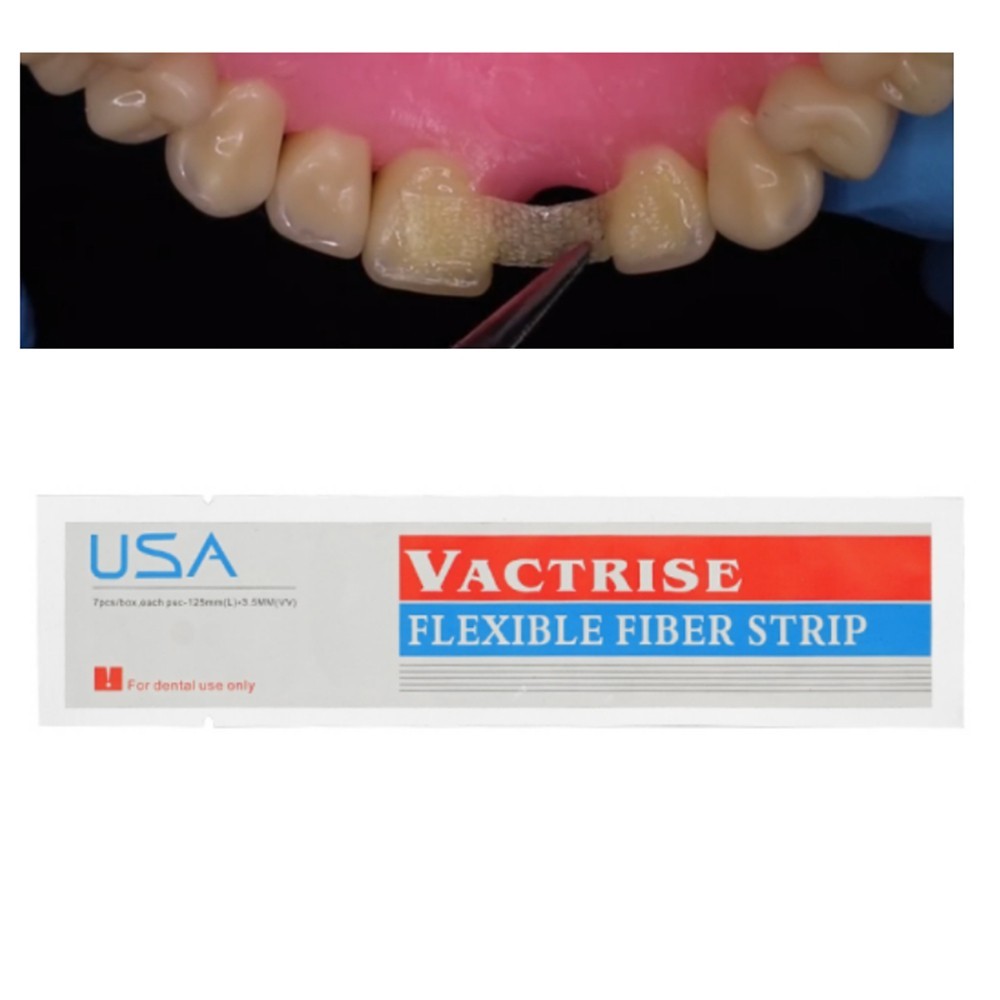 Dental Flexible Fiber Strip Glass Splint Loose Tooth Light Cure Bonding 125*3.5