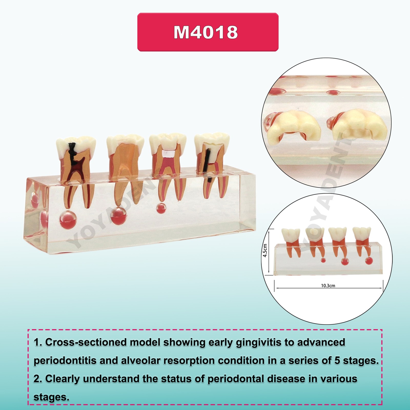 US Dental Teeth Model Implant Periodontal Disease Suture Drilling Training Demo