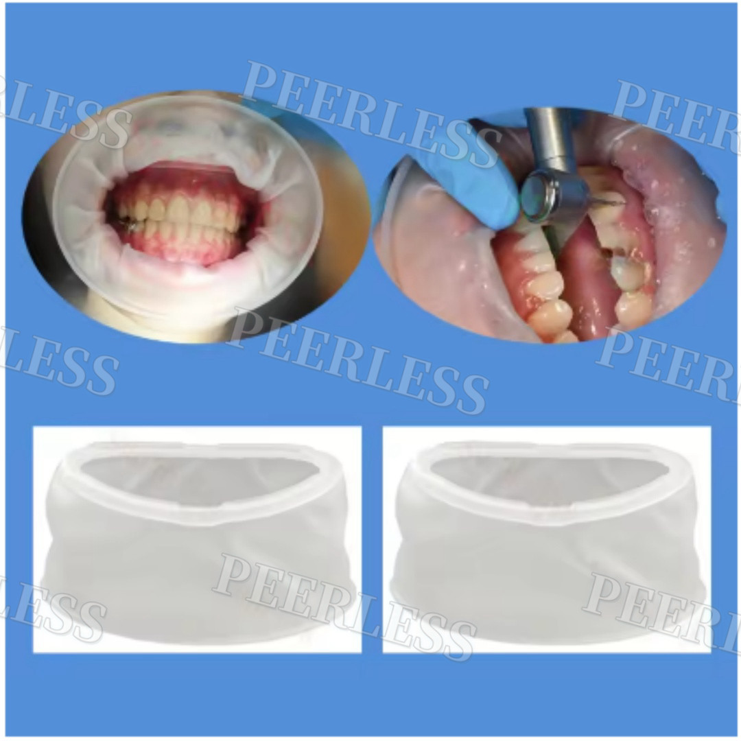Dental Mouth Opener Lip Cheek Retractors O Shape Intraoral Lip Expander Opener M