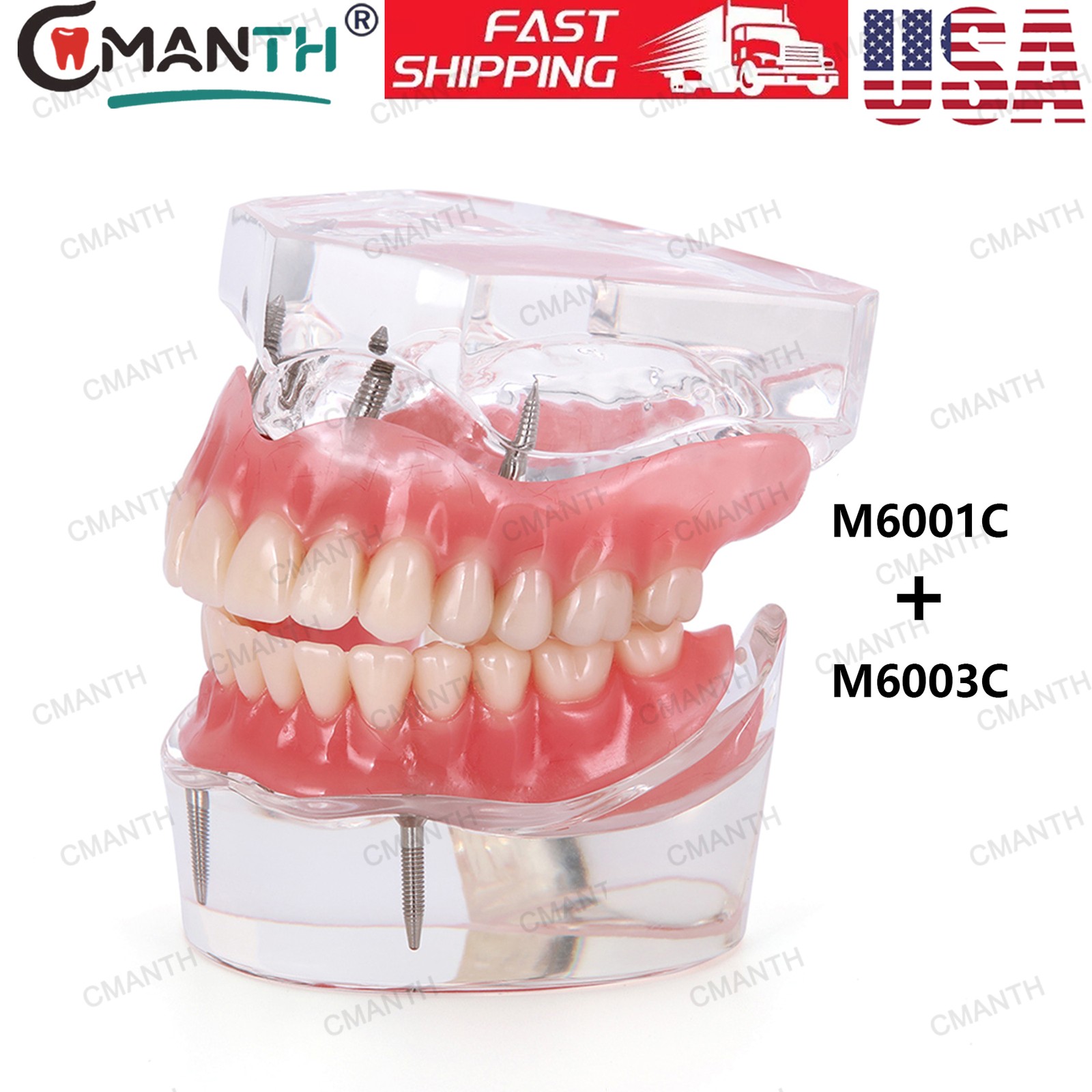 US Dental Teeth Model Implant Periodontal Disease Suture Drilling Training Demo