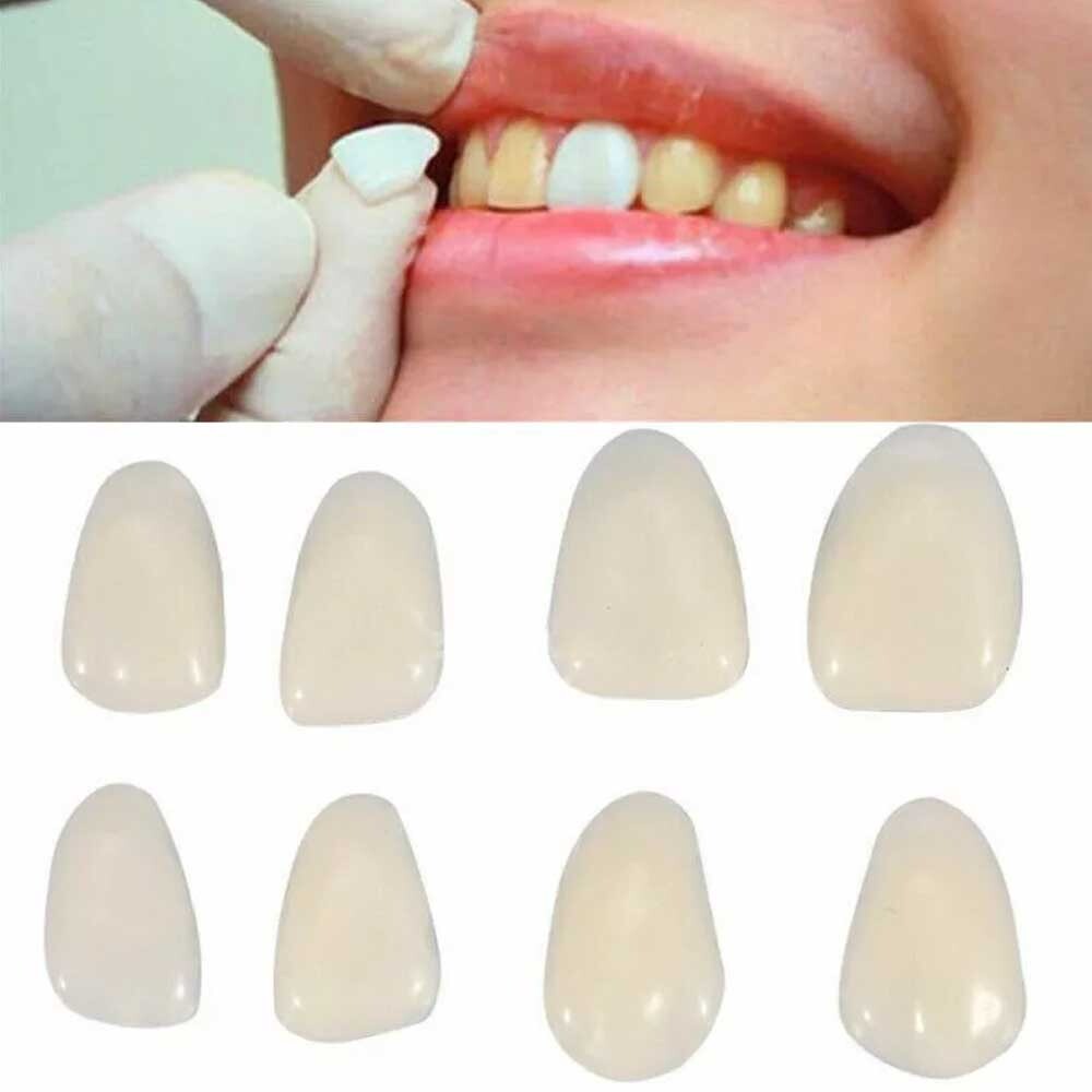 96PCS/Card Dental Tooth Veneer Anterior Resin Thin Teeth Veneers Porcelain 23#A2