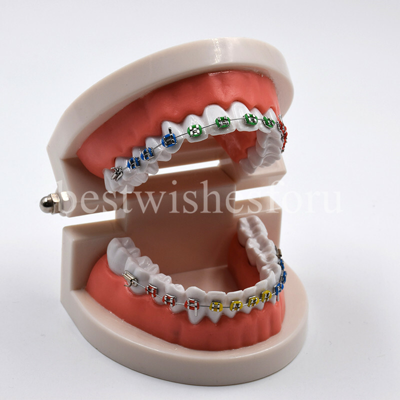 1*Dental Orthodontic Standard Teeth Tooth Model Metal Brackets & Ligature Ties