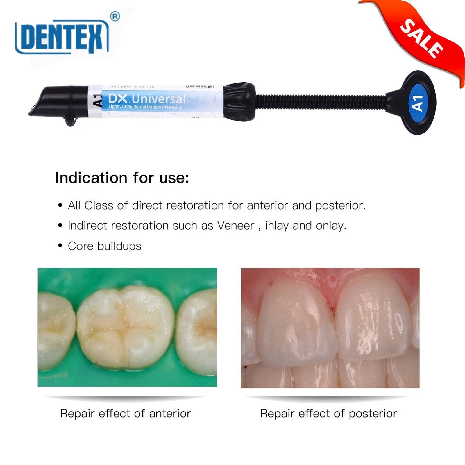 Dental Restorative Universal Composite Syringe Body Enamel Dentine ALL Shades
