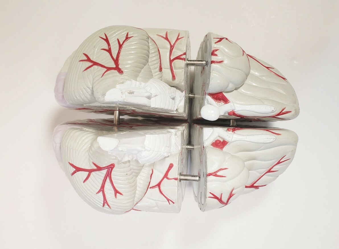 Human Brain Anatomical Teaching Model Life Size Medical Science Cross 4 Sections