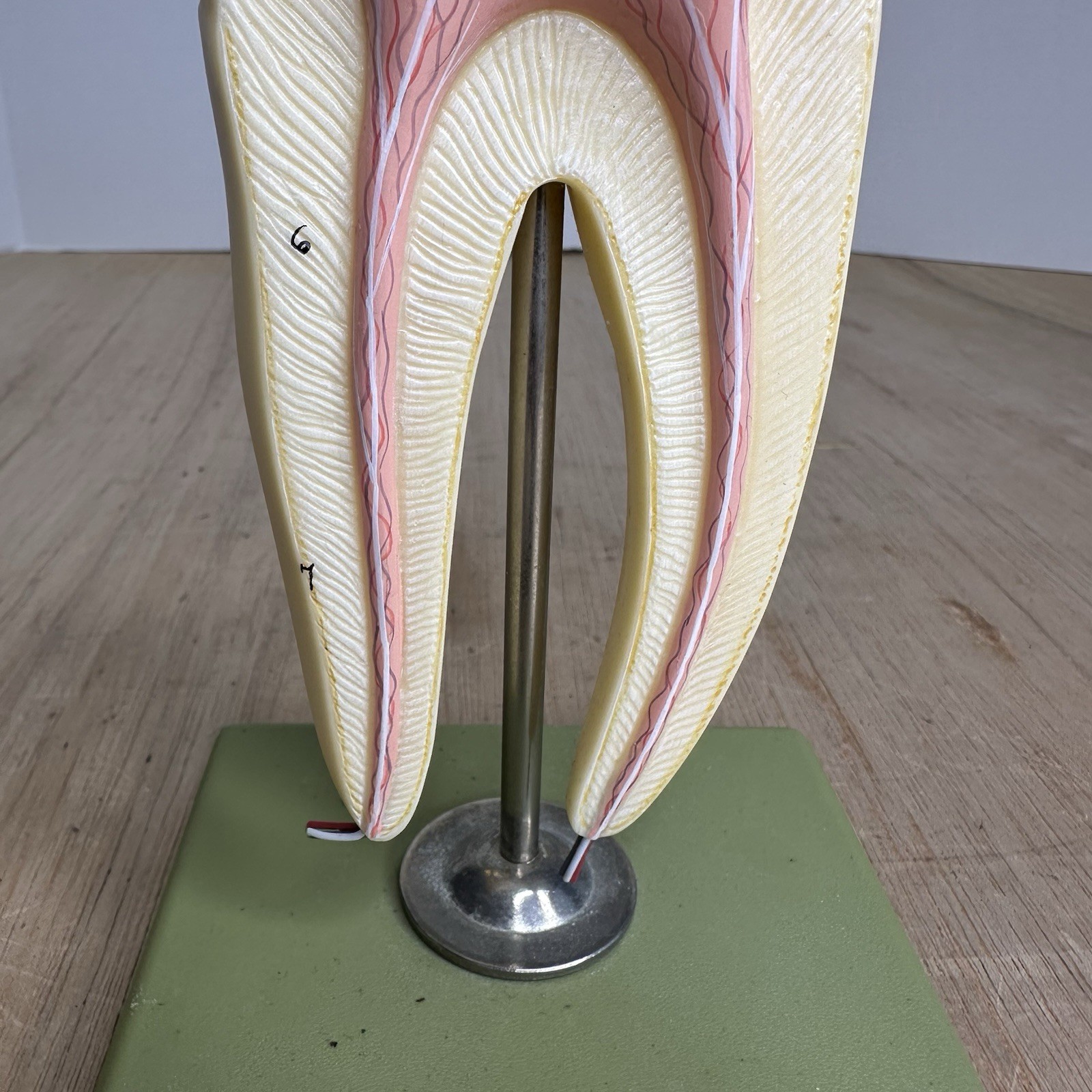 VTG SOSMO TOOTH ANATOMICAL MODEL DISPLAY DENTAL DENTISTRY EDUCTATIONAL GERMANY