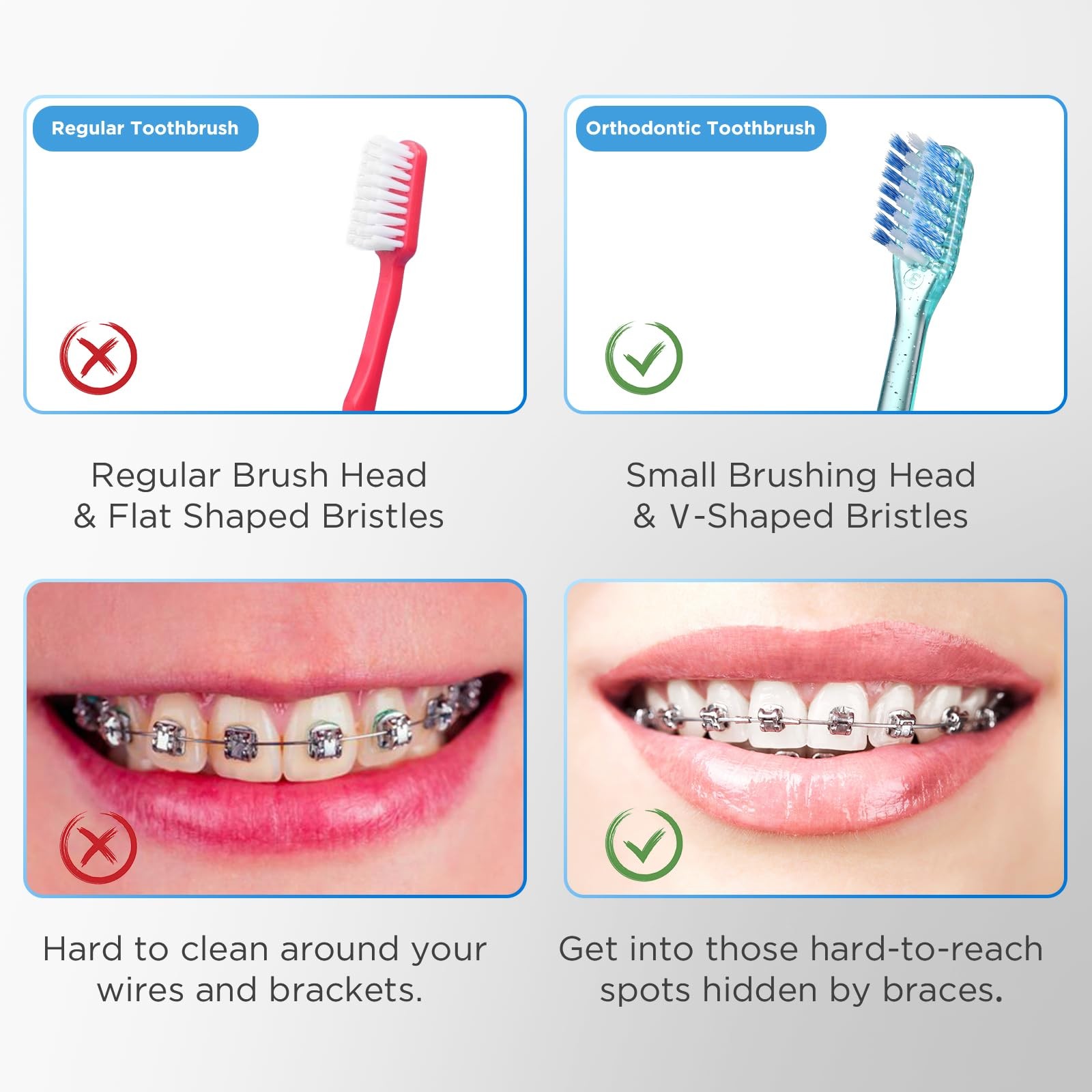 Fregum V-Shaped Orthodontic Toothbrush for 1 Count (Pack of 6), Multi-colored