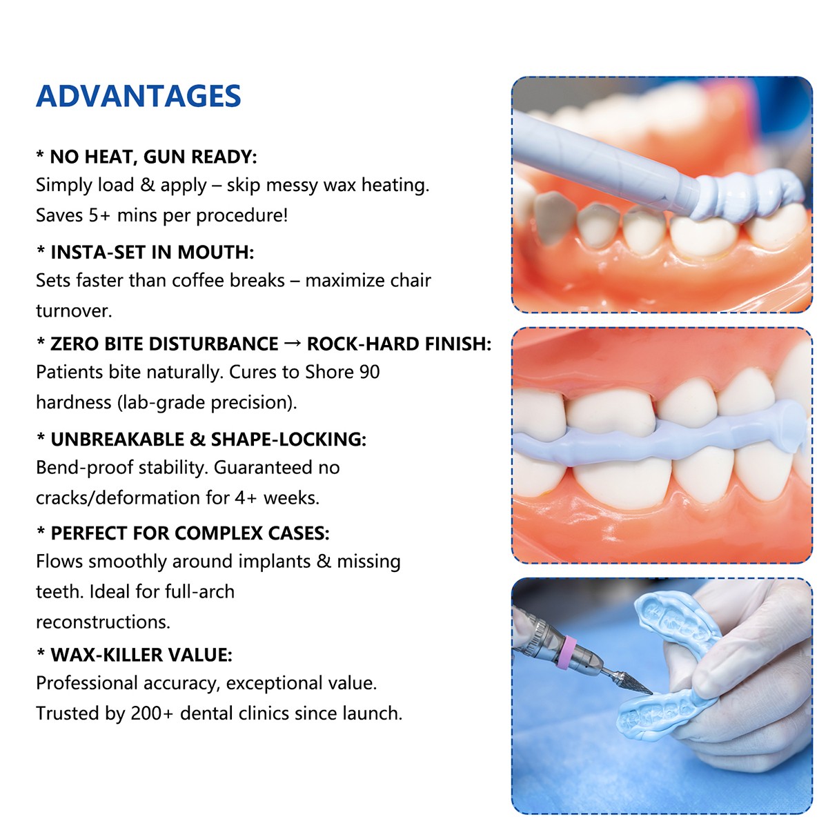 Silicone dental A para el material de registro mordedura Mezcla/Conjunto rápido