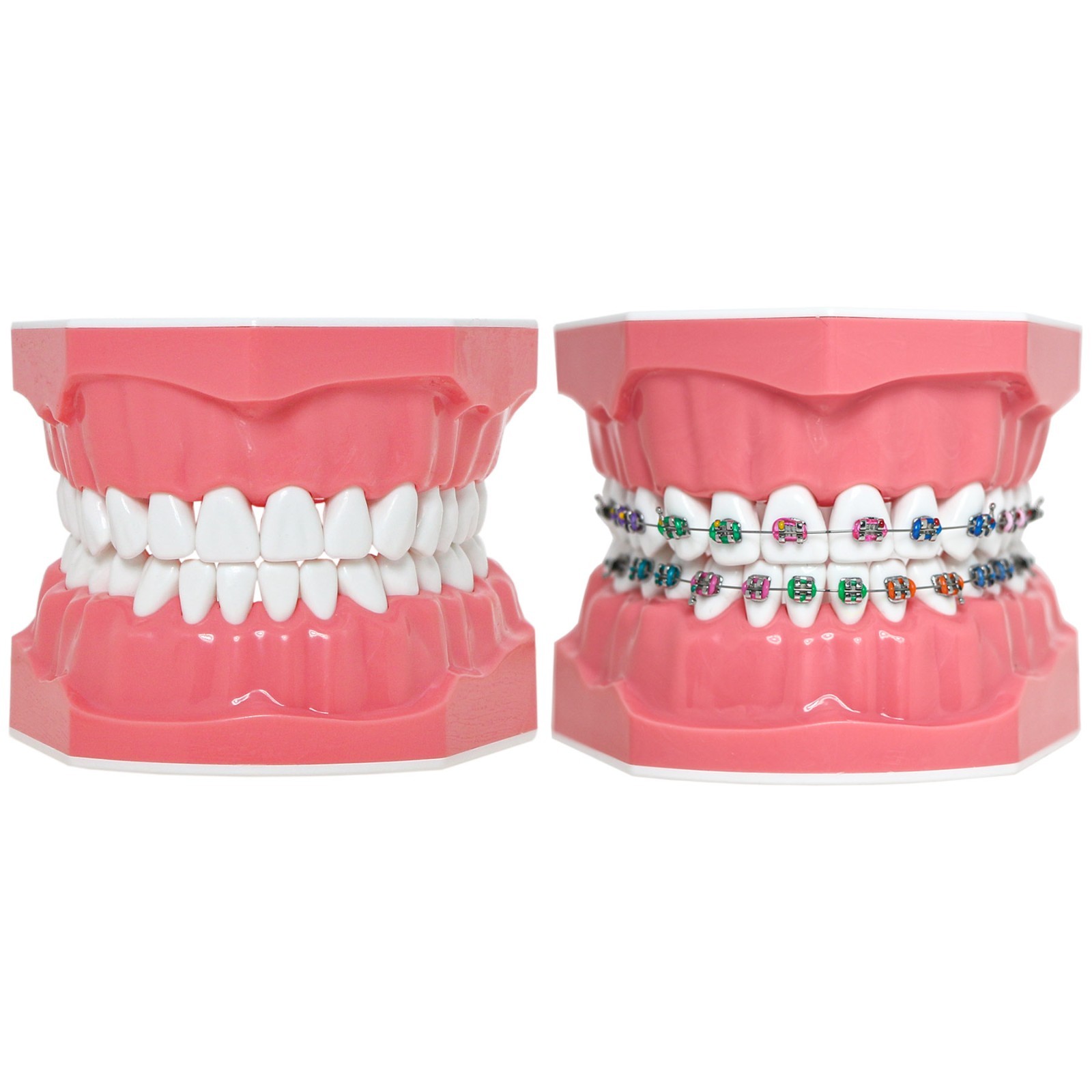 US M7010 Series Typodont M7010-1 Hygiene/M7010-2 Orthodontic Bracket Teeth Model