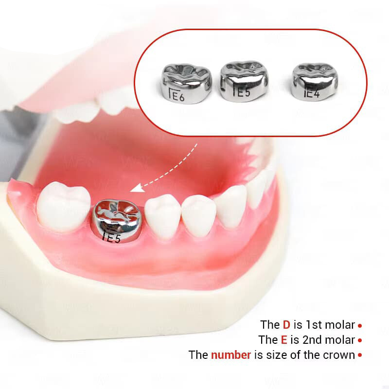 48pcs Stainless Steel Dental Kids Primary Molar Crowns Preformed Pediatric USA