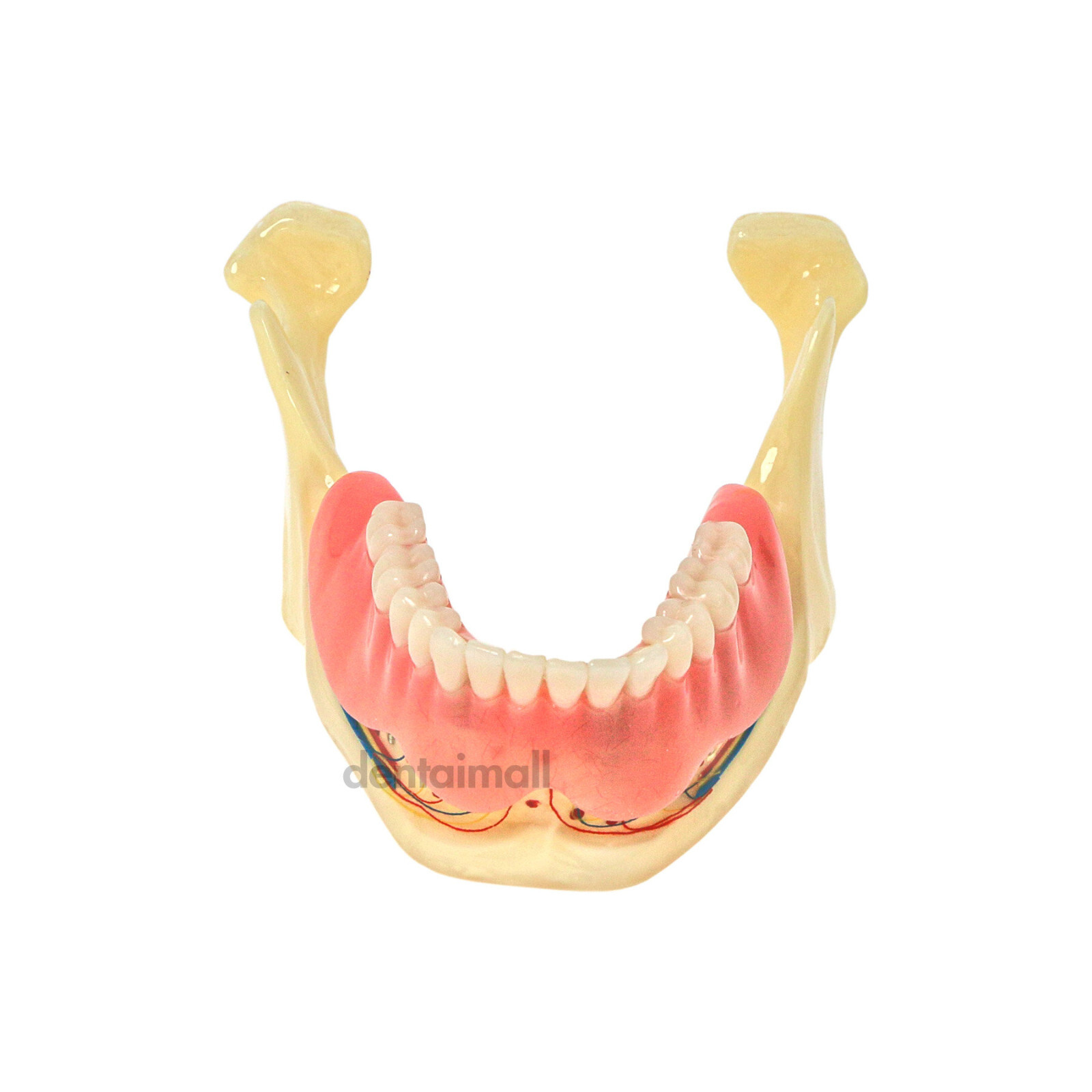 Implant Typodont Teeth Restoration Model Overdenture Practice Demo Series Dental