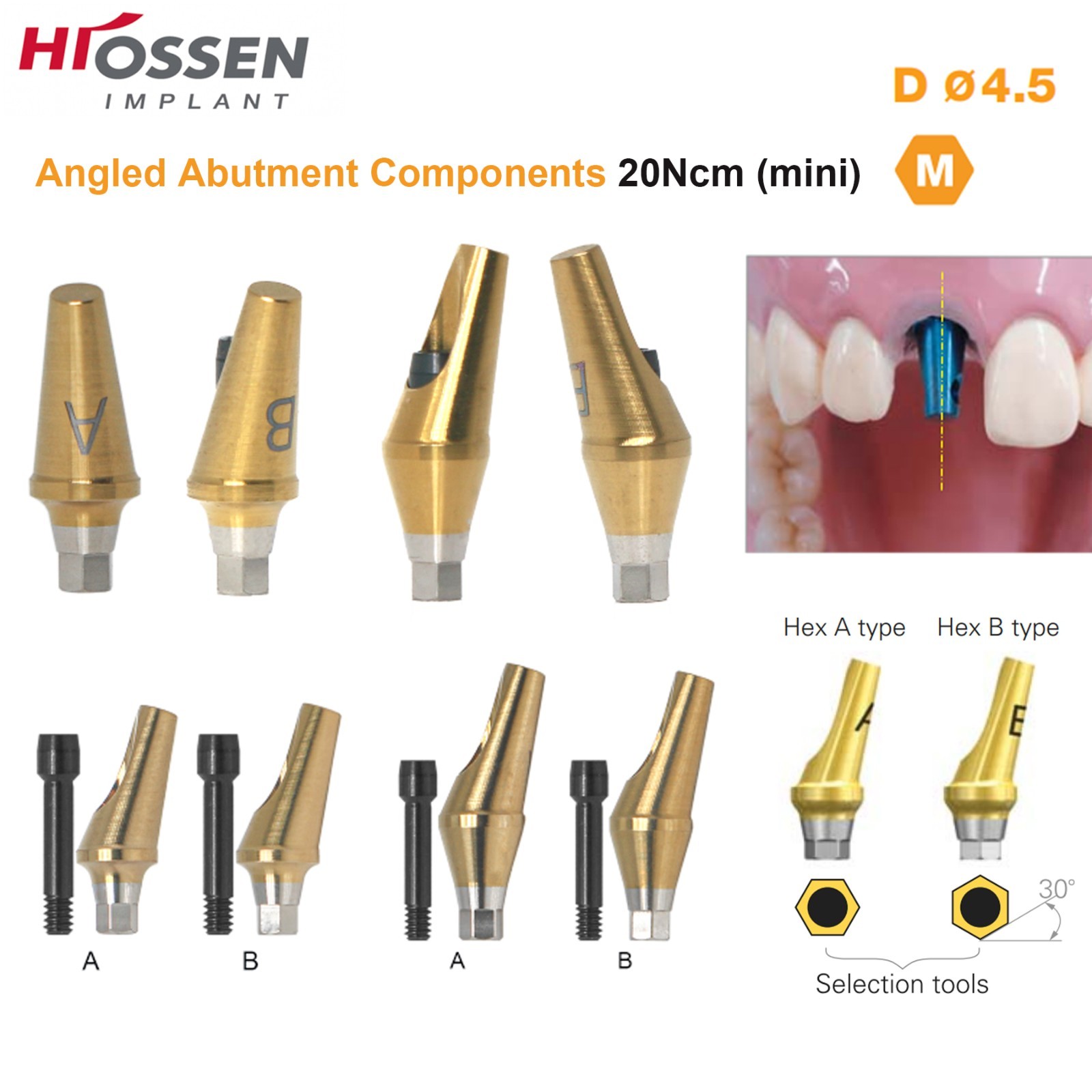 US 17° Angulated Abutment Mini/Regular Hex A/B Transfer Fit Osstem TS/Hiossen ET