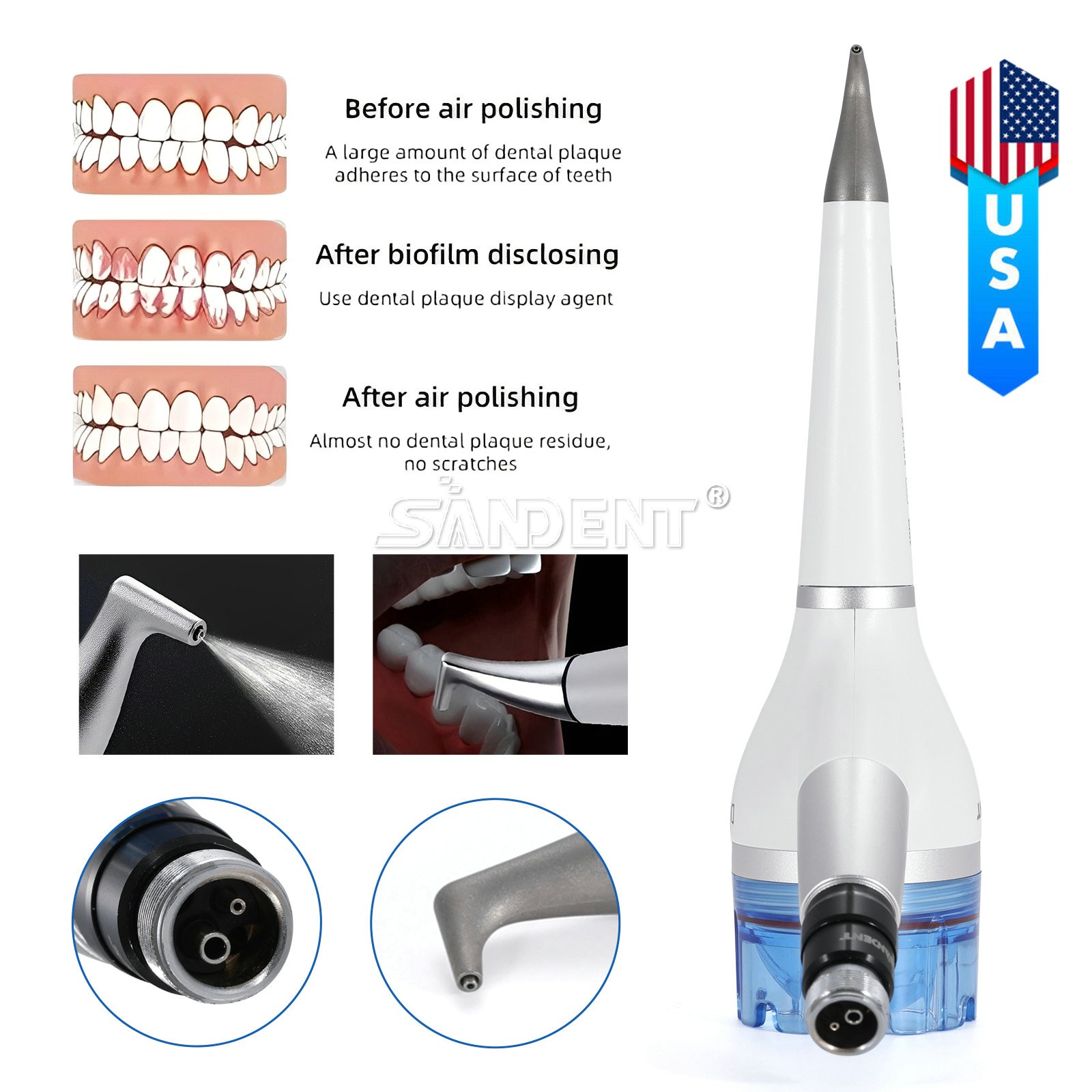 Dental Universal Implant Prosthetic Kit Torque Wrench Screw Drivers Remover USA