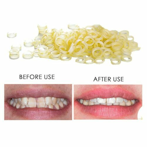 3.5 oz Dental Orthodontic Rubber Bands Elastics Latex Braces Forces 1/8 Chipmunk