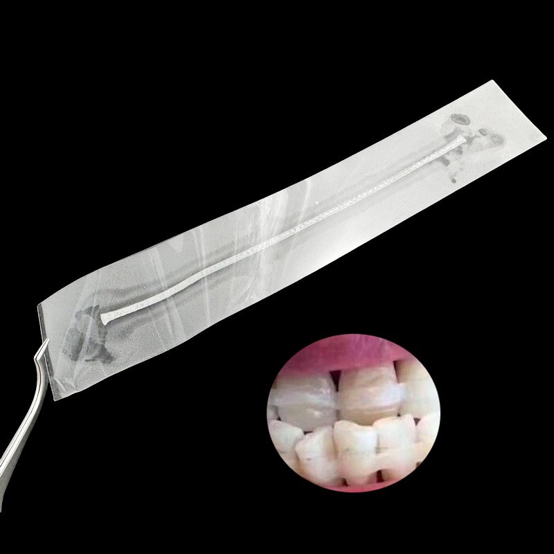 Dental Flexible Fiber Strip Glass Splint Loose Tooth Fixat Strip Light Cure Bond