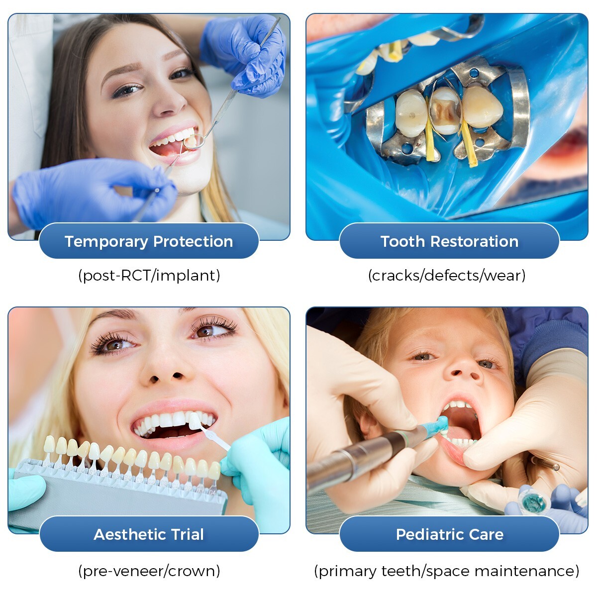 Dental Resin Anterior/Posterior Temporary Porcelain Tooth Crown Veneers Repair
