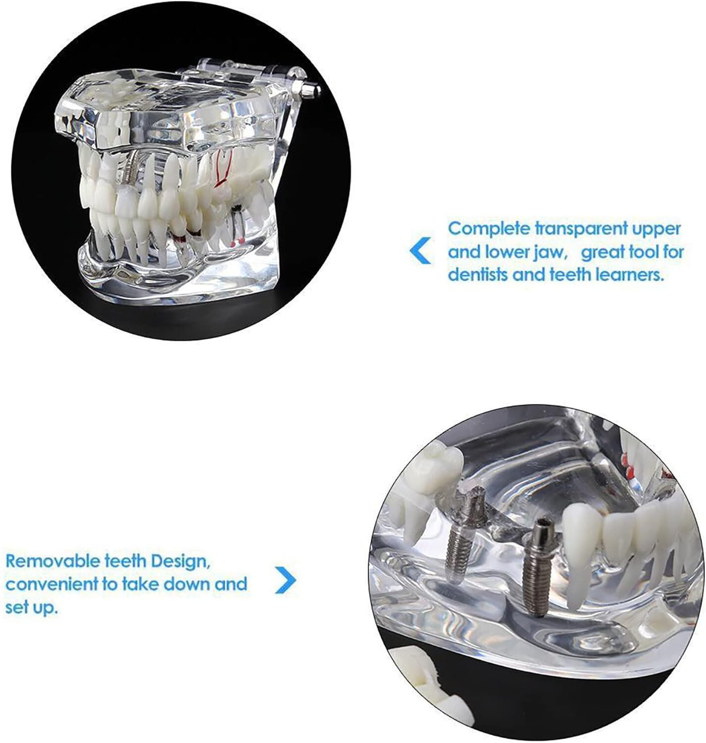 Dental Oral Typodont Model Implant Pathological Removable Teach Visible Anatomy