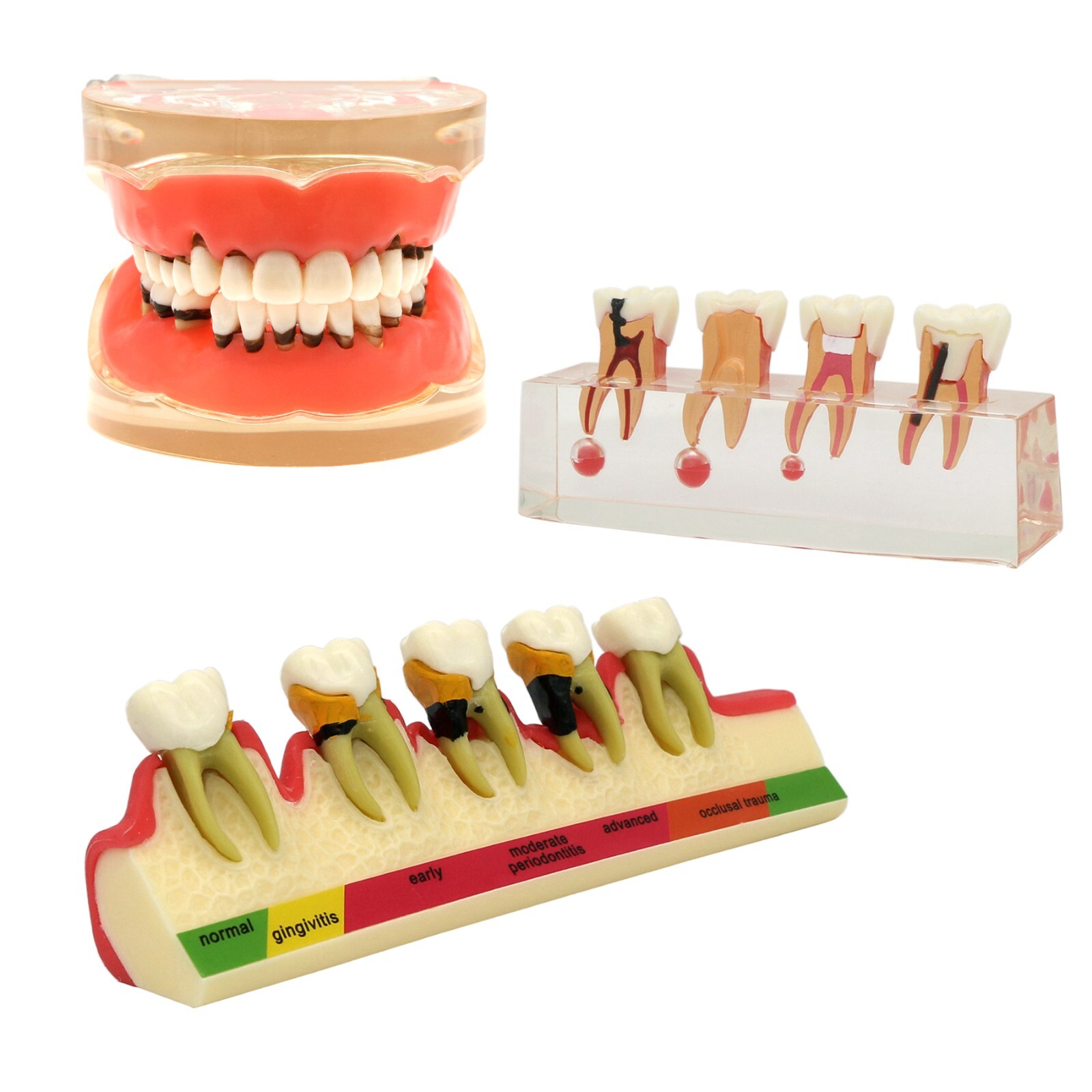 Dental Typodont Teeth Model Ortho Implant Pathological Perio Practice Demo Model