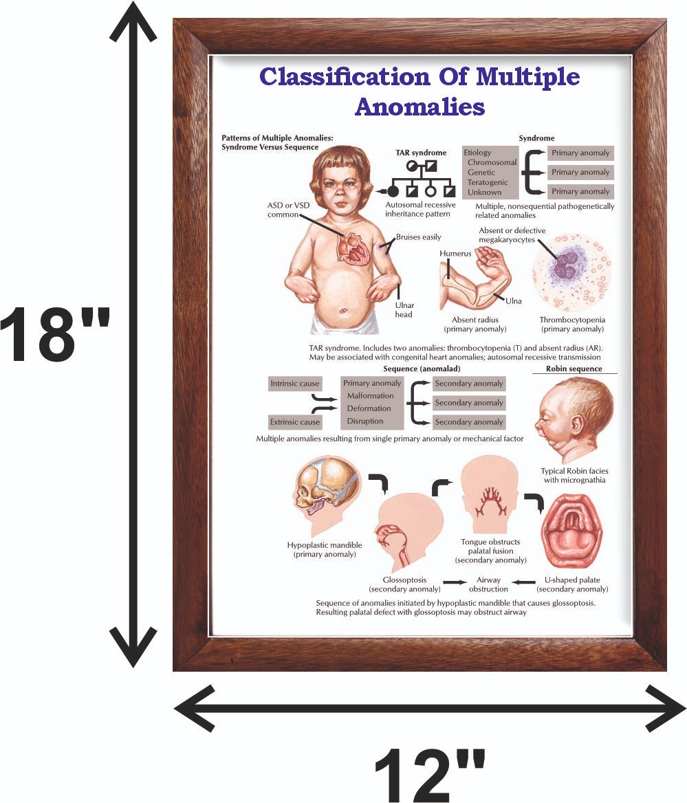 Classification Of Multiple Anomalies Chart 12×18 inches