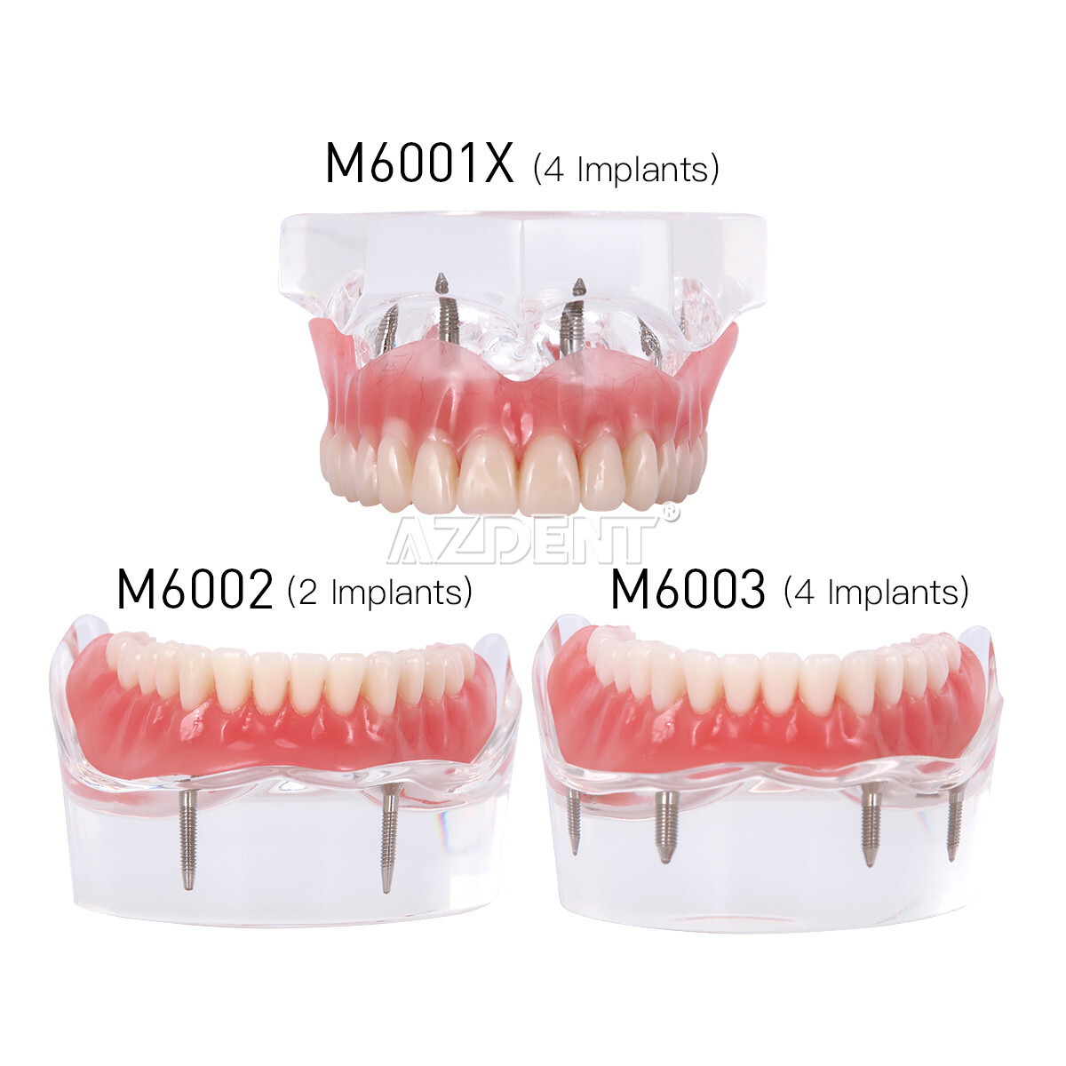 Dental Overdenture Implant Teeth Model Denture with implant Demonstration Clear