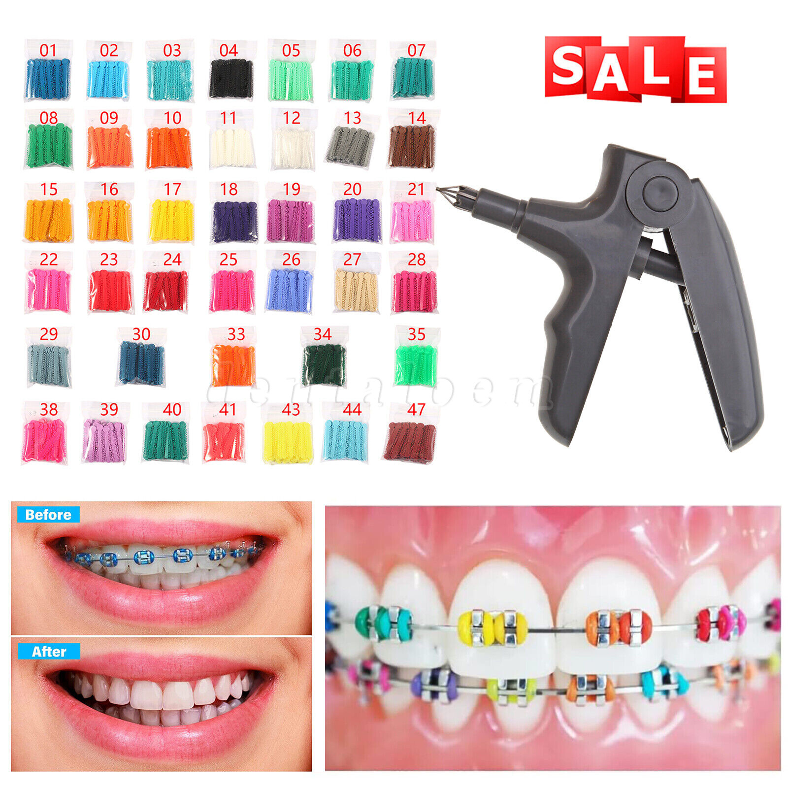 Ligature Gun / 1040 ties Rubber Bands for Orthodontic Dental Braces Brackets