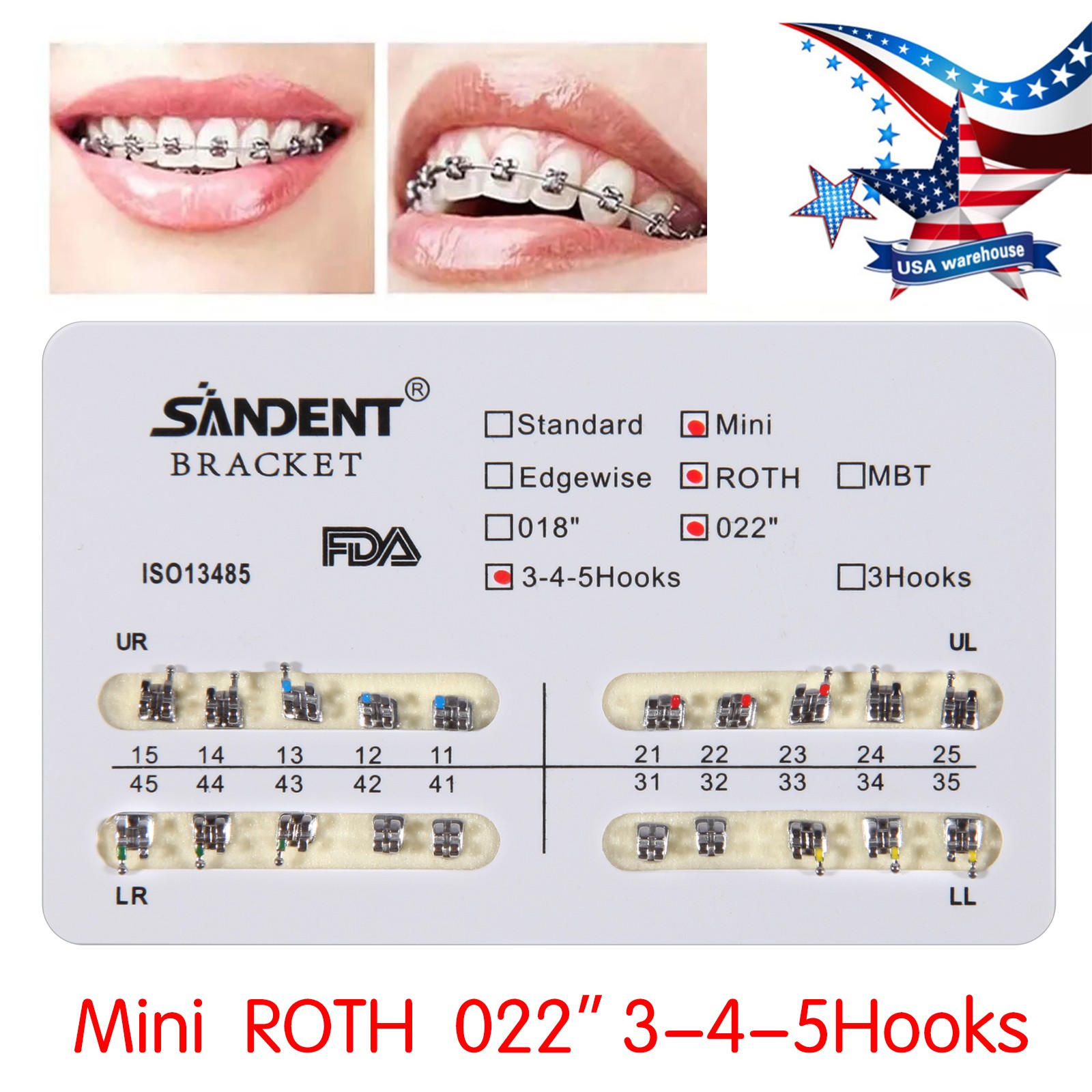 5X Puntas de escalador ultrasónico dental P1 Fit EMS Cavitron pieza de mano USA
