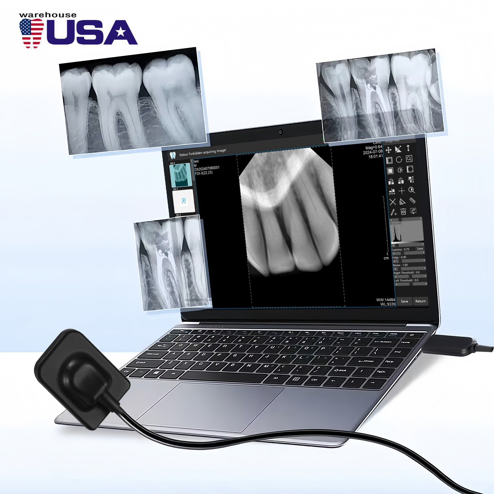 Dental X Sensor ray Digital Sensor Rayos Digital Imaging System Size 1 + Holder