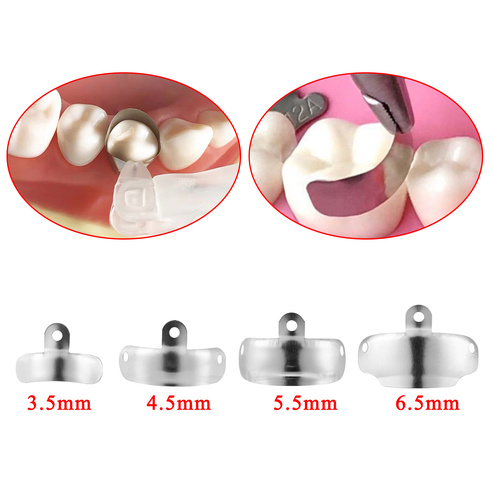 50pcs/Box Dental Metal Matrices Sectional Contoured Matrix Refill Soft Band