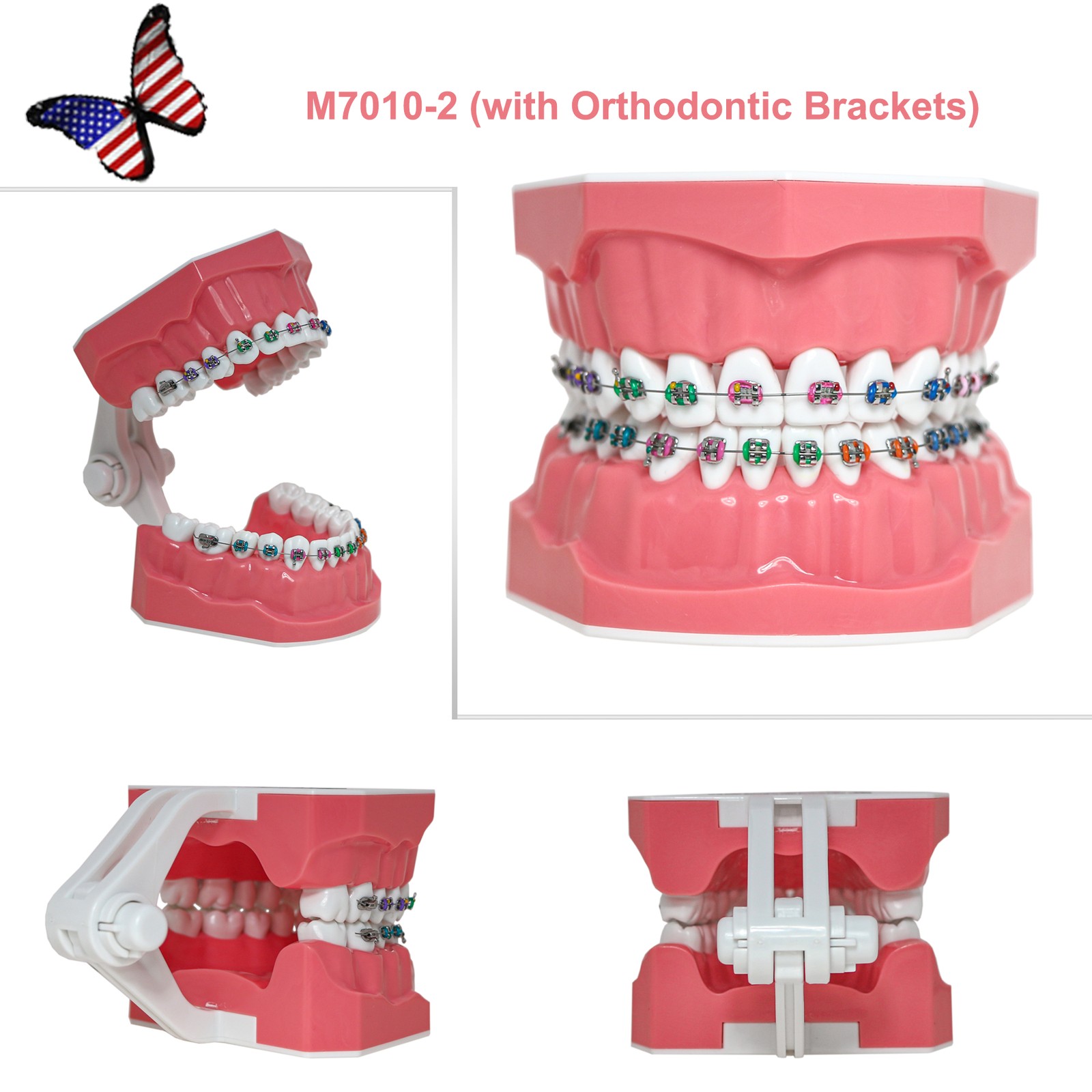 US Dental Overdenture/Implant/Orthodontic Typodont Ortho Training Teaching Model