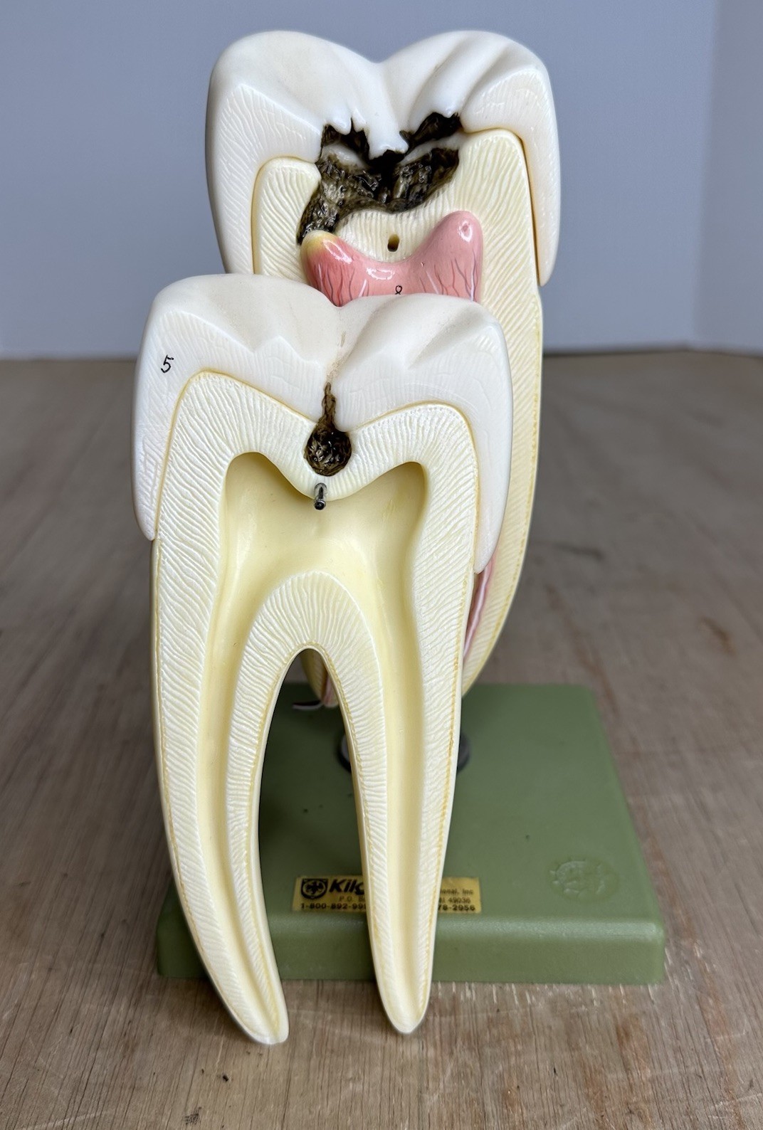 VTG SOSMO TOOTH ANATOMICAL MODEL DISPLAY DENTAL DENTISTRY EDUCTATIONAL GERMANY
