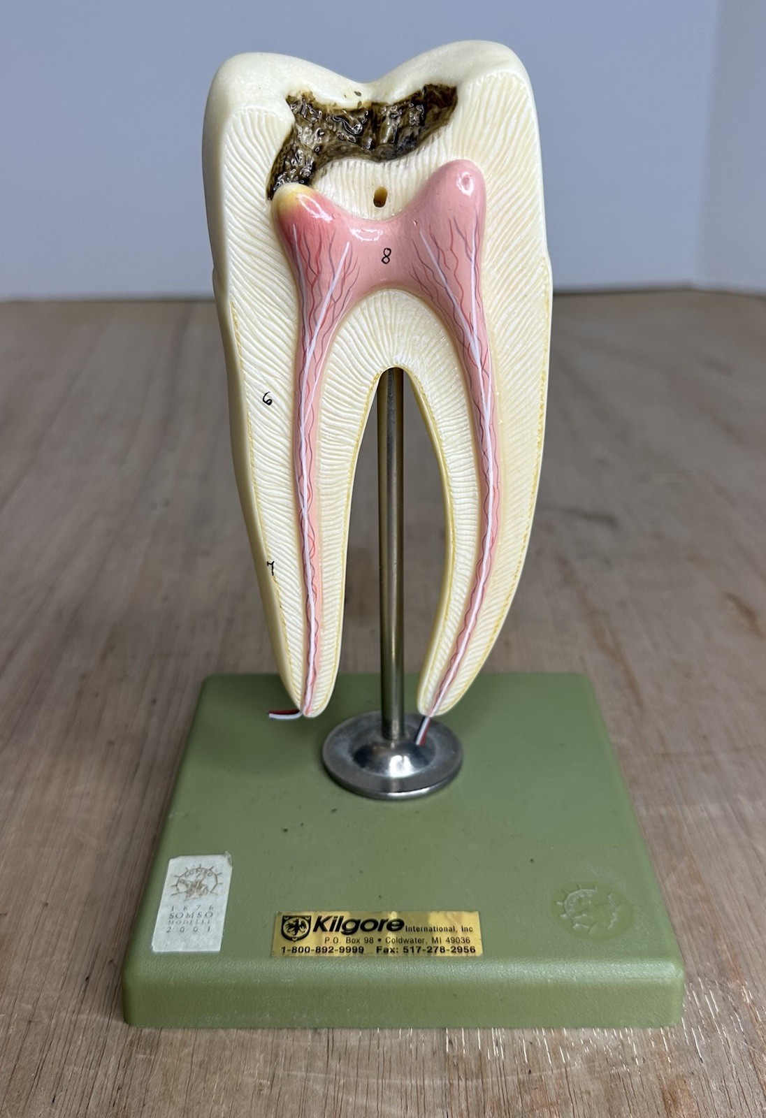 VTG SOSMO TOOTH ANATOMICAL MODEL DISPLAY DENTAL DENTISTRY EDUCTATIONAL GERMANY