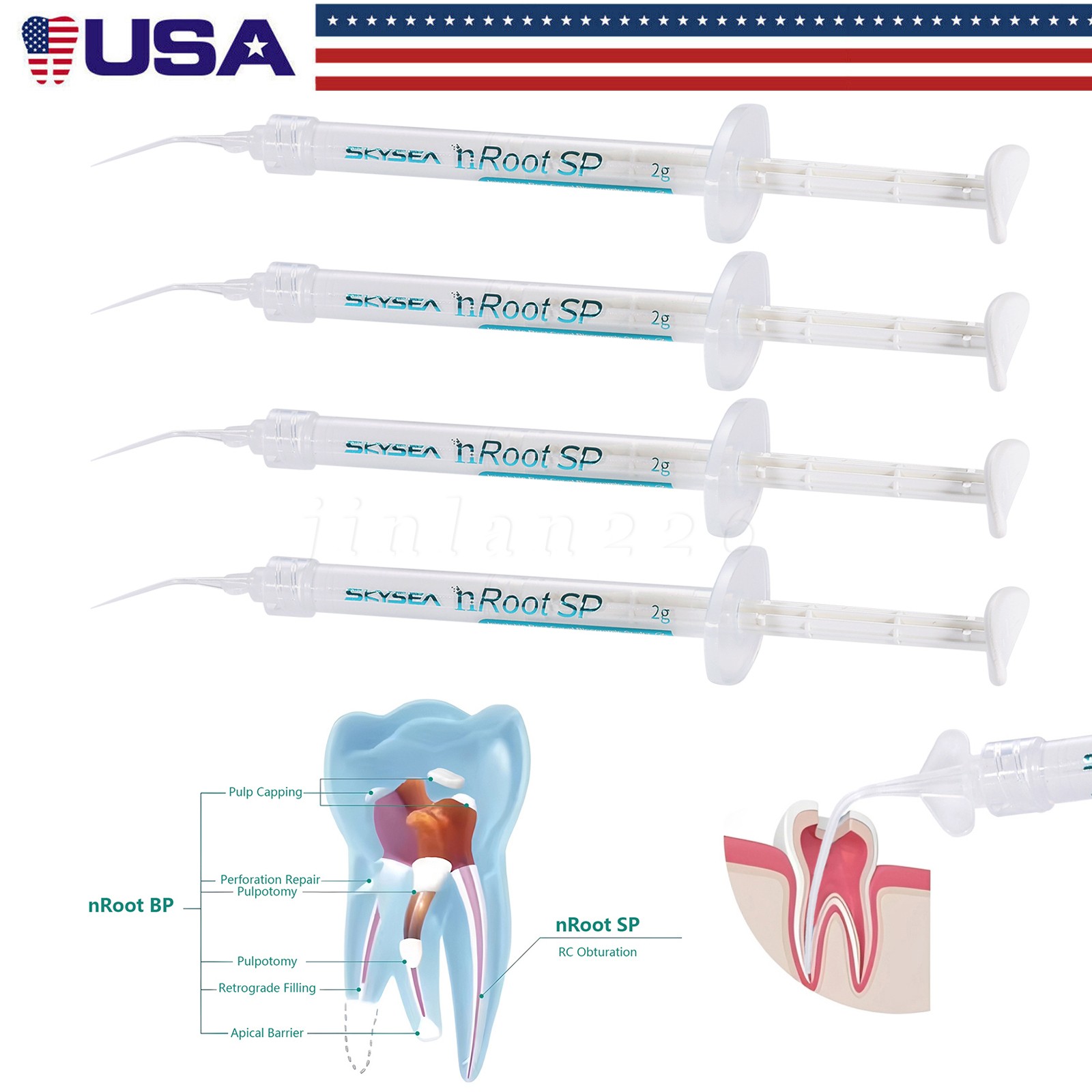 1g SP Dental Injectable Root Canal Bioceramic Sealer Endodontic Sealing Filling