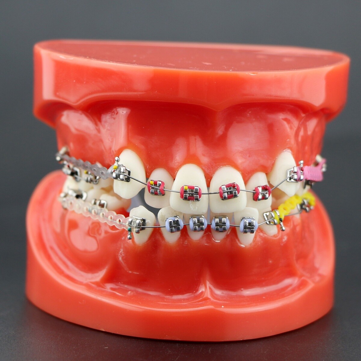 Dental Typodont Teeth Model Orthodontic Treatment Metal Ceramic BracketsRetainer