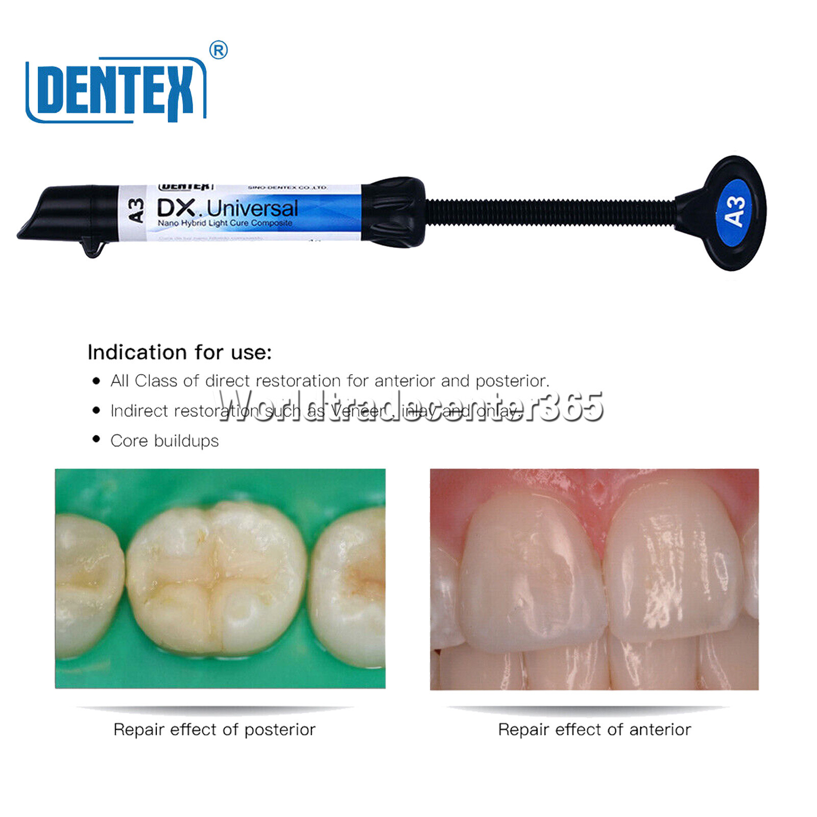 Dental Dentex Universal /Flowable Medium Flow Light Cure Composite Resin Refill