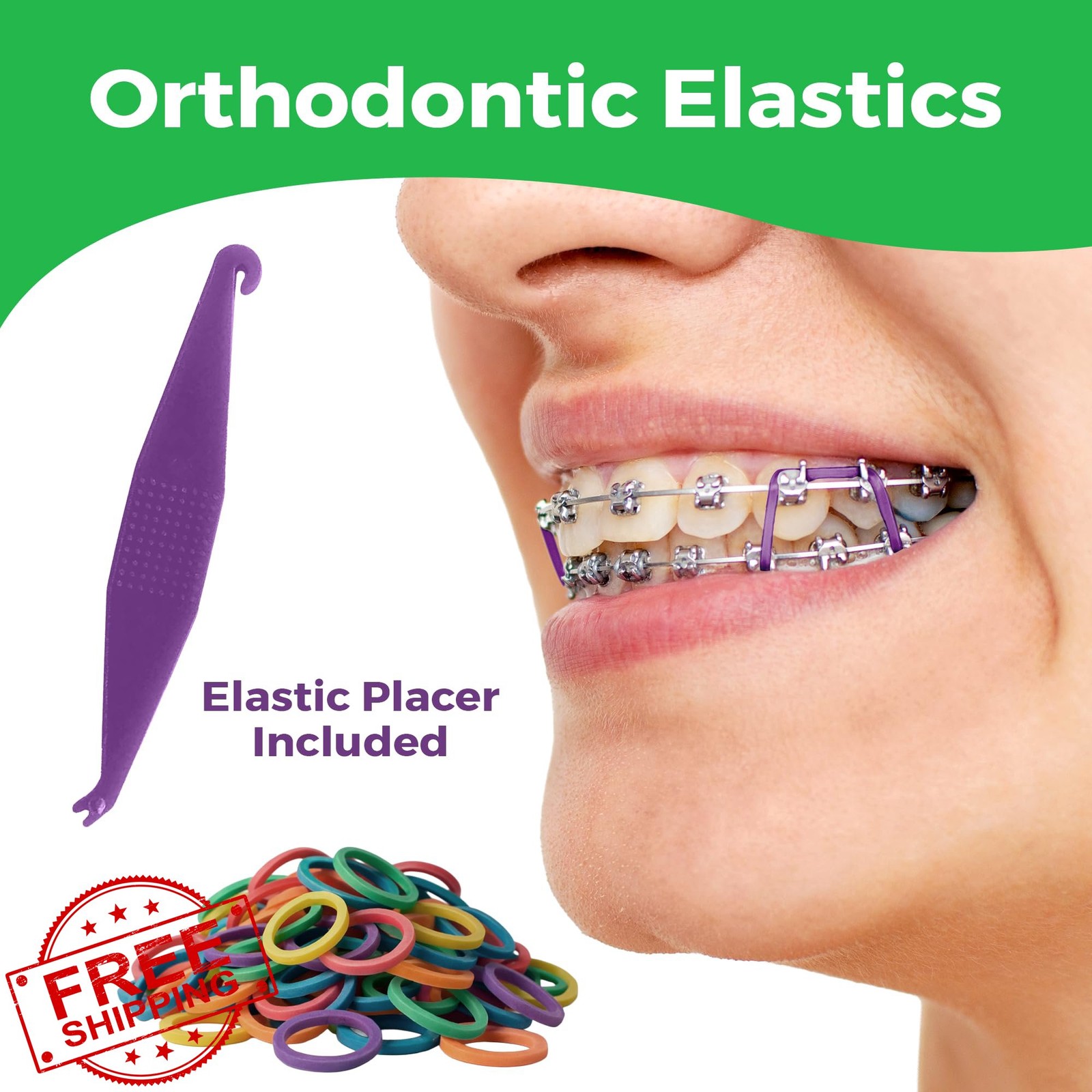 Orthodontic Rubber Bands Braces 5/16 Medium Force 3.5oz Neon 100 Pack Elastics